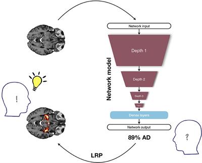 Layer-Wise Relevance Propagation for Explaining Deep Neural Network Decisions in MRI-Based Alzheimer's Disease Classification